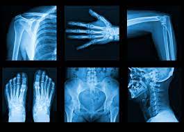 Department of Radiology