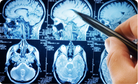 Neurology and Psychiatry
